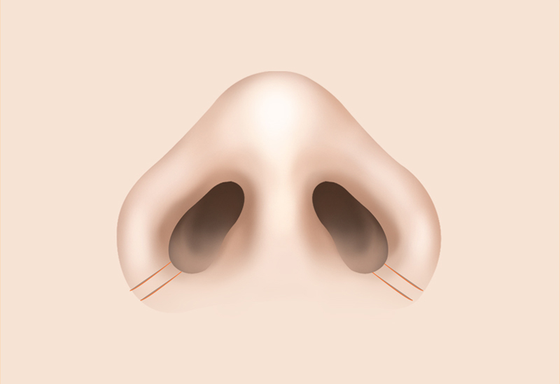 콧볼 디자인